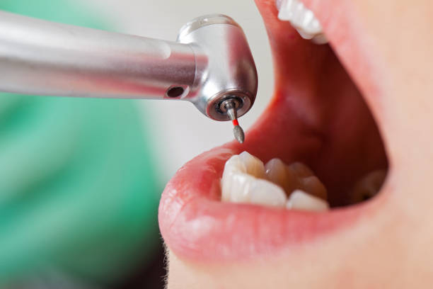 Best Pediatric Emergency Dentist in Siena College, NY